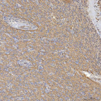 SRPRA Rabbit Polyclonal Antibody
