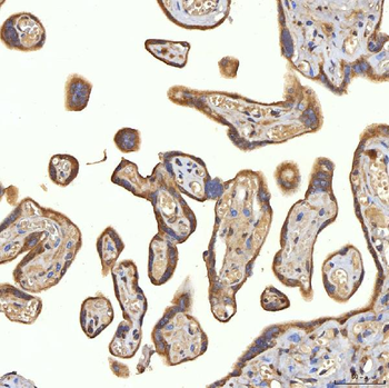 SRPRA Rabbit Polyclonal Antibody
