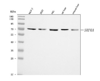 SRPRA Rabbit Polyclonal Antibody