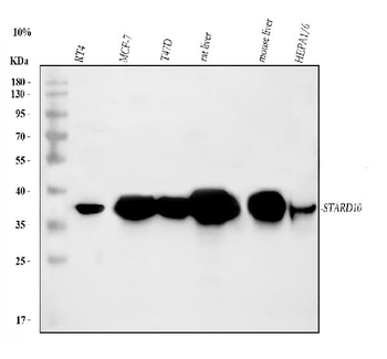 PCTP-L/STARD10/PCTP Rabbit Polyclonal Antibody