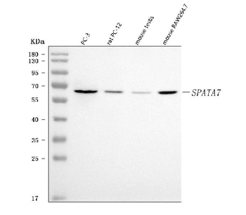 SPATA7 Rabbit Polyclonal Antibody