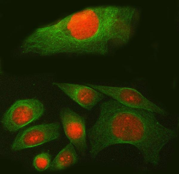 SPAG7 Rabbit Polyclonal Antibody