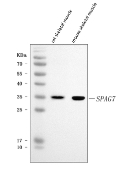 SPAG7 Rabbit Polyclonal Antibody