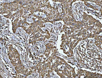 Porin/VDAC1 Antibody