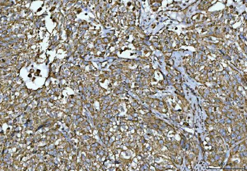 Porin/VDAC1 Antibody