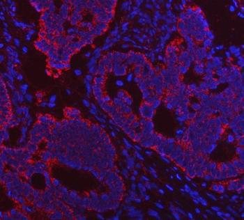Porin/VDAC1 Antibody