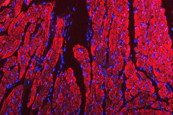 Porin/VDAC1 Antibody