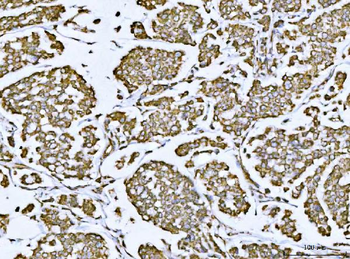 Porin/VDAC1 Antibody