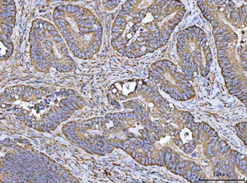 Porin/VDAC1 Antibody