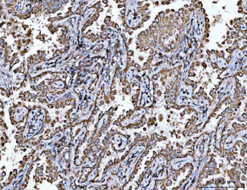 Porin/VDAC1 Antibody