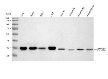 PYCR2 Rabbit Polyclonal Antibody