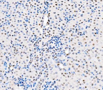 ASC/TMS1/PYCARD Antibody