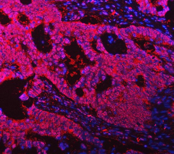 ASC/TMS1/PYCARD Antibody
