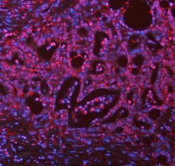 ASC/TMS1/PYCARD Antibody