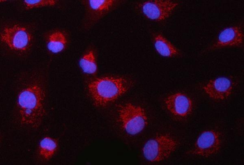 ASC/TMS1/PYCARD Antibody