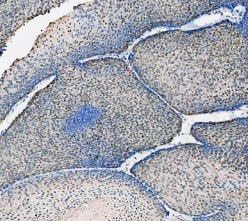 ASC/TMS1/PYCARD Antibody