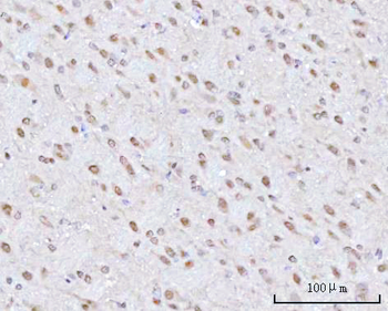 PSMD4 Antibody