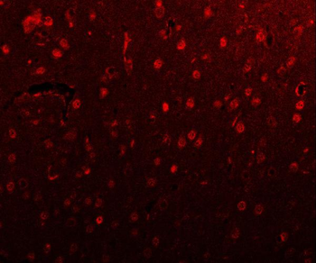 PSMD4 Antibody