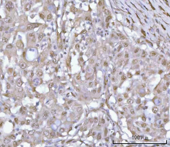 PSMD4 Antibody