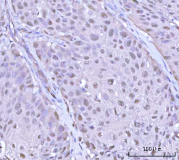 PSMD4 Antibody