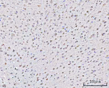 PSMD4 Antibody