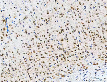 POH1/PSMD14 Antibody