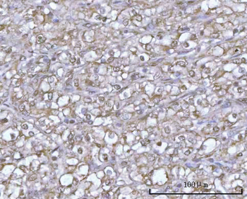 POH1/PSMD14 Antibody