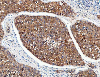 POH1/PSMD14 Antibody