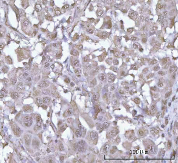 POH1/PSMD14 Antibody