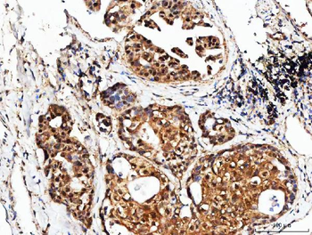 POH1/PSMD14 Antibody