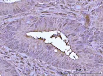 POH1/PSMD14 Antibody