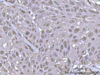 POH1/PSMD14 Antibody