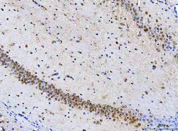 POH1/PSMD14 Antibody