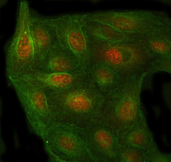 PSMC4 Antibody