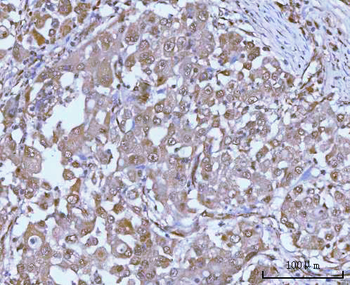 PSMC4 Antibody
