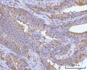 PSMC4 Antibody