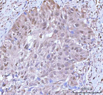 PSMC4 Antibody