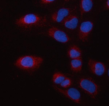 PSMC2 Rabbit Polyclonal Antibody