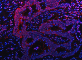 PSMB9 Rabbit Polyclonal Antibody