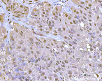 PSMA1 Antibody