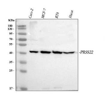 PRSS22 Rabbit Polyclonal Antibody
