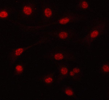 PRPF6 Rabbit Polyclonal Antibody