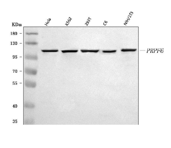 PRPF6 Rabbit Polyclonal Antibody