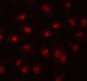PRPF39 Rabbit Polyclonal Antibody