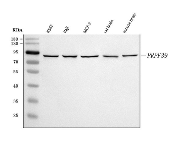 PRPF39 Rabbit Polyclonal Antibody