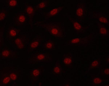 PRPF19 Rabbit Polyclonal Antibody