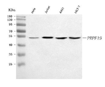 PRPF19 Rabbit Polyclonal Antibody
