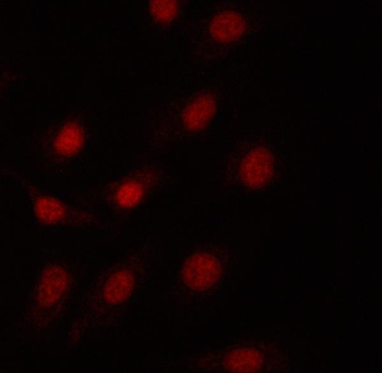 PRPF18 Antibody