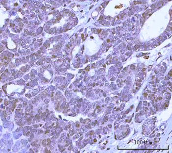 PRPF18 Antibody