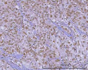 PRPF18 Antibody